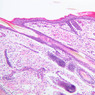 Skin and Sensory Receptors