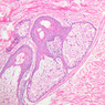 Skin and Sensory Receptors