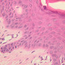 Skin and Sensory Receptors