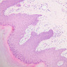 Skin and Sensory Receptors