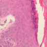 Skin and Sensory Receptors