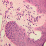 Skin and Sensory Receptors