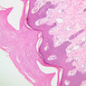 Skin and Sensory Receptors