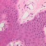 Skin and Sensory Receptors