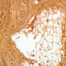 Skin and Sensory Receptors