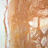 Skin and Sensory Receptors