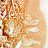 Skin and Sensory Receptors