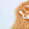 Skin and Sensory Receptors