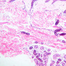 Skin and Sensory Receptors