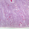 B70, Renal Corpuscle, 2.5x (Carmine)