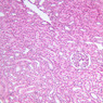 B67, DCT, 10x (H&E)