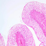 B75, Bladder (contracted), 10x (H&E)