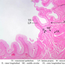 B75, Bladder (contracted), 2.5x Labeled (H&E)