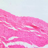 B76, Bladder (distended), 20x (H&E)