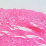 B76, Bladder (distended), 40x (H&E)