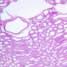 Extracted from AllUrinarySystem.zip