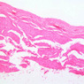 Extracted from AllUrinarySystem.zip